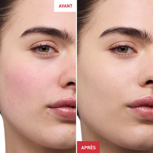 Crème anti-rougeurs